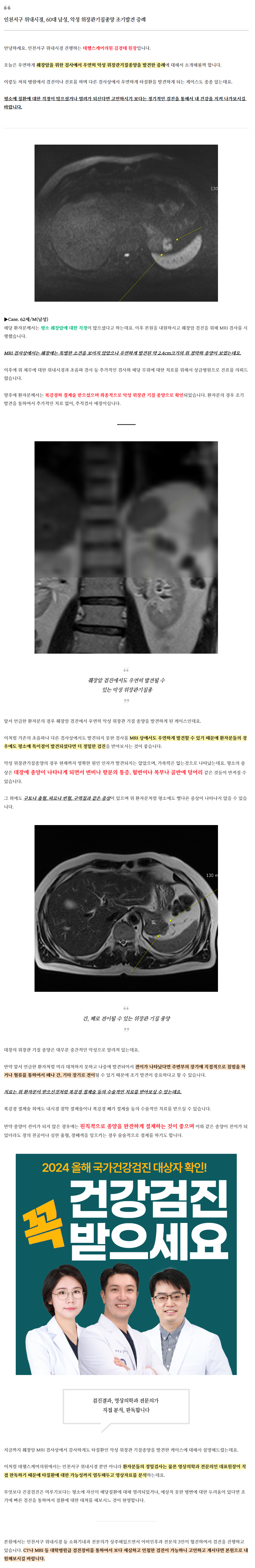 MRI 검진 시 우연히 발견된 '악성 위장관기질종양' 증례 관련 이미지 2