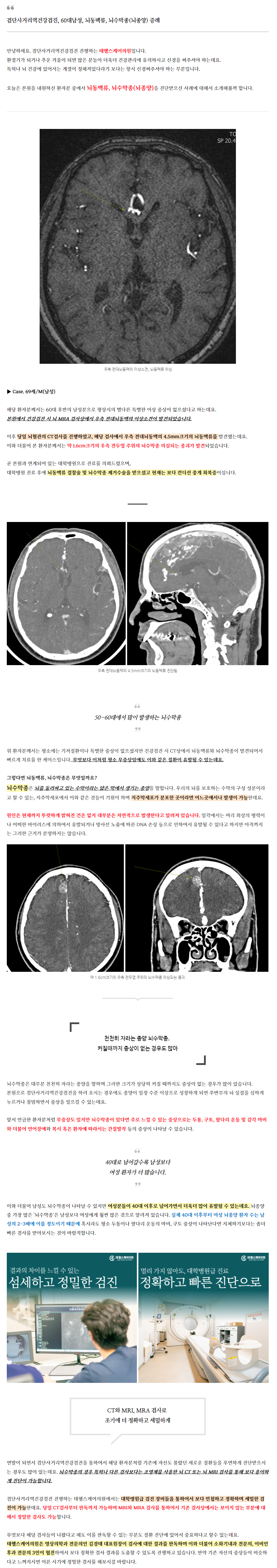 60대 남성, 뇌동맥류 뇌수막종(뇌종양) 증례 관련 이미지 2