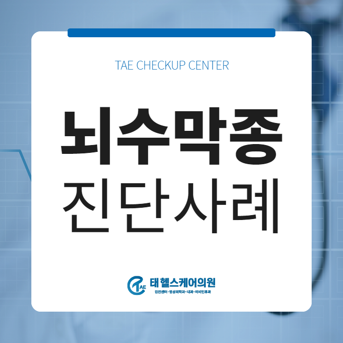 60대 남성, 뇌동맥류 뇌수막종(뇌종양) 증례 관련 이미지