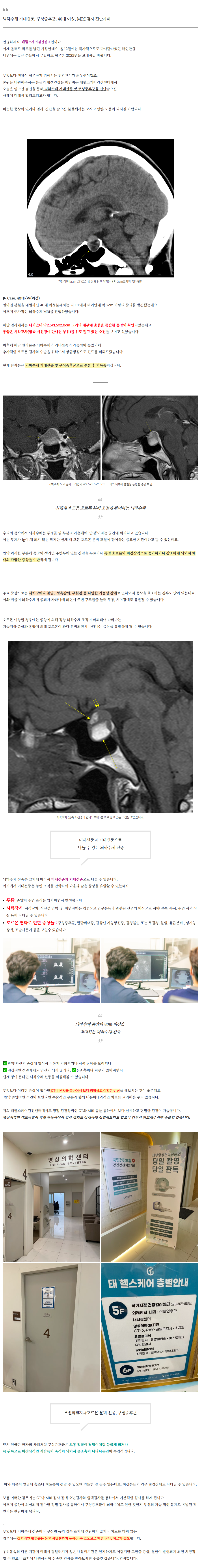 뇌하수체 거대선종, 쿠싱증후군, 40대 여성, MRI 검사 진단사례 관련 이미지 2