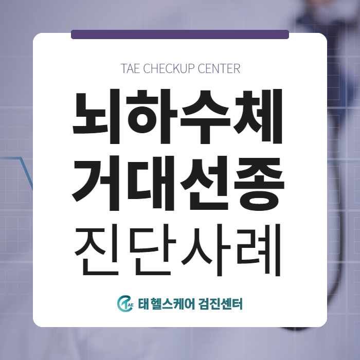 뇌하수체 거대선종, 쿠싱증후군, 40대 여성, MRI 검사 진단사례 관련 이미지