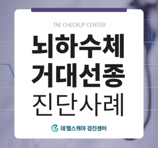뇌하수체 거대선종, 쿠싱증후군, 40대 여성, MRI 검사 진단사례