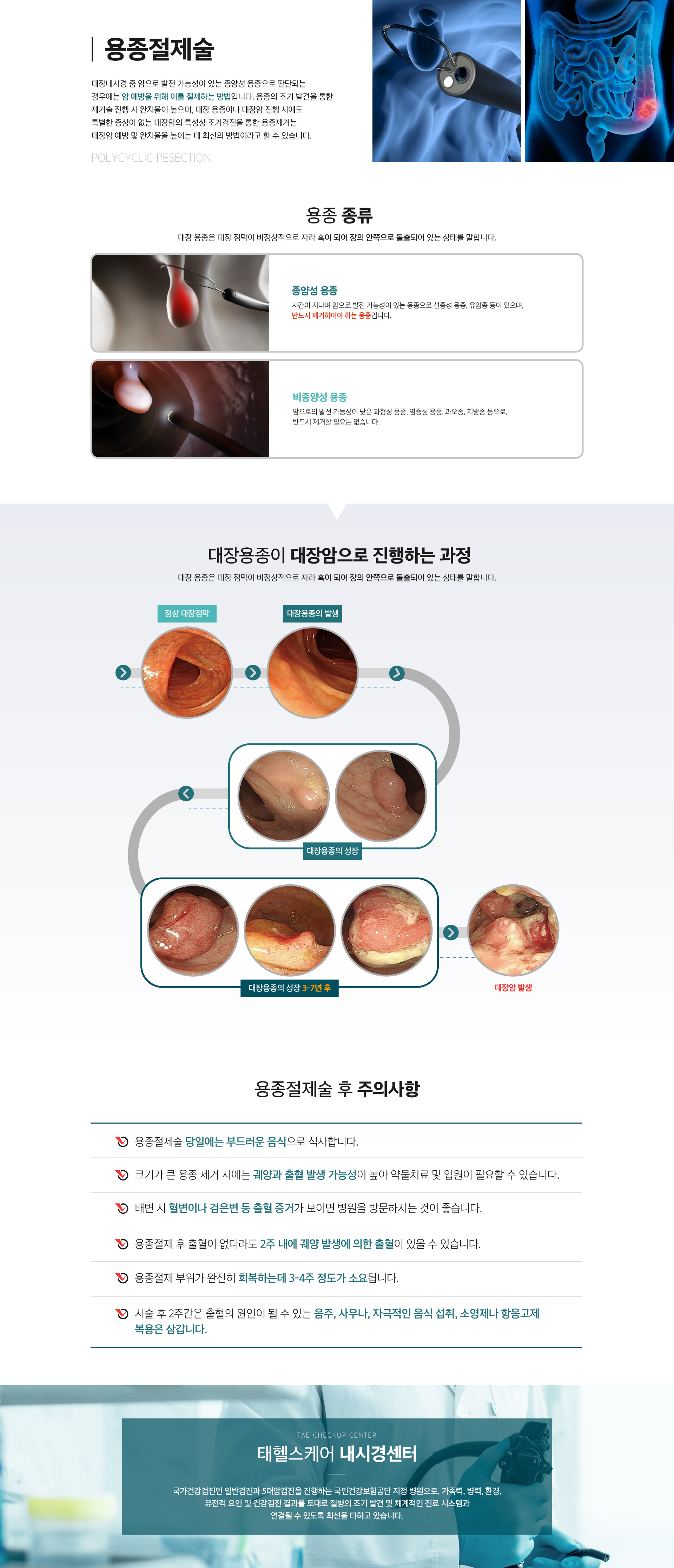 소화기내시경 안내 이미지