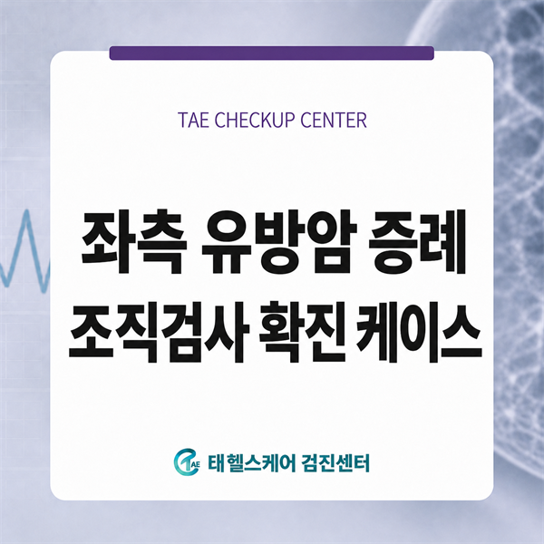 국가 암검진 유방촬영 후, 당일 초음파·조직검사로 확인한 좌측 유방암 대표 이미지
