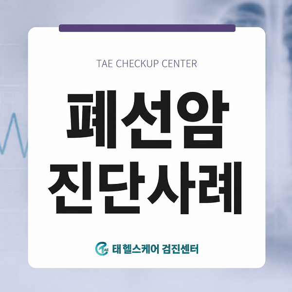 본원 폐CT 검사를 통한, 폐선암 발견 증례 대표 이미지
