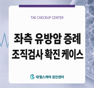 국가 암검진 유방촬영 후, 당일 초음파·조직검사로 확인한 좌측 유방암