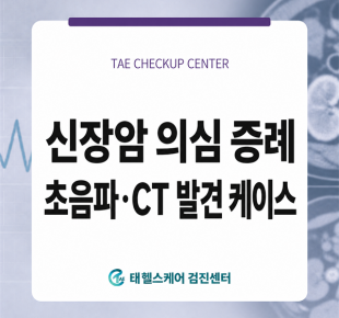 검단 건강검진 복부초음파에서 발견된 우측 신장 종괴, CT로 신장암 의심