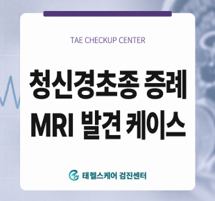인천 검단구 MRI 검사, 70대 여성 청력 저하 증상과 청신경초종 증례